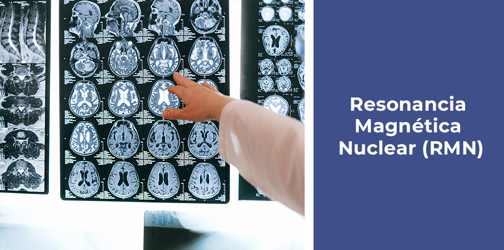 Resonancia Magnética Nuclear (RMN)