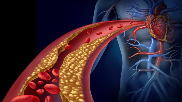 Pirroloisoindolonas nuevos inhibidores de la enzima convertidora de la angiotensina (IECAS) para el tratamiento de la tensión arterial