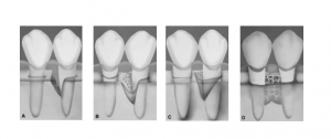 Proteína cementogenina osteogénica, composición farmacéutica y uso de la misma